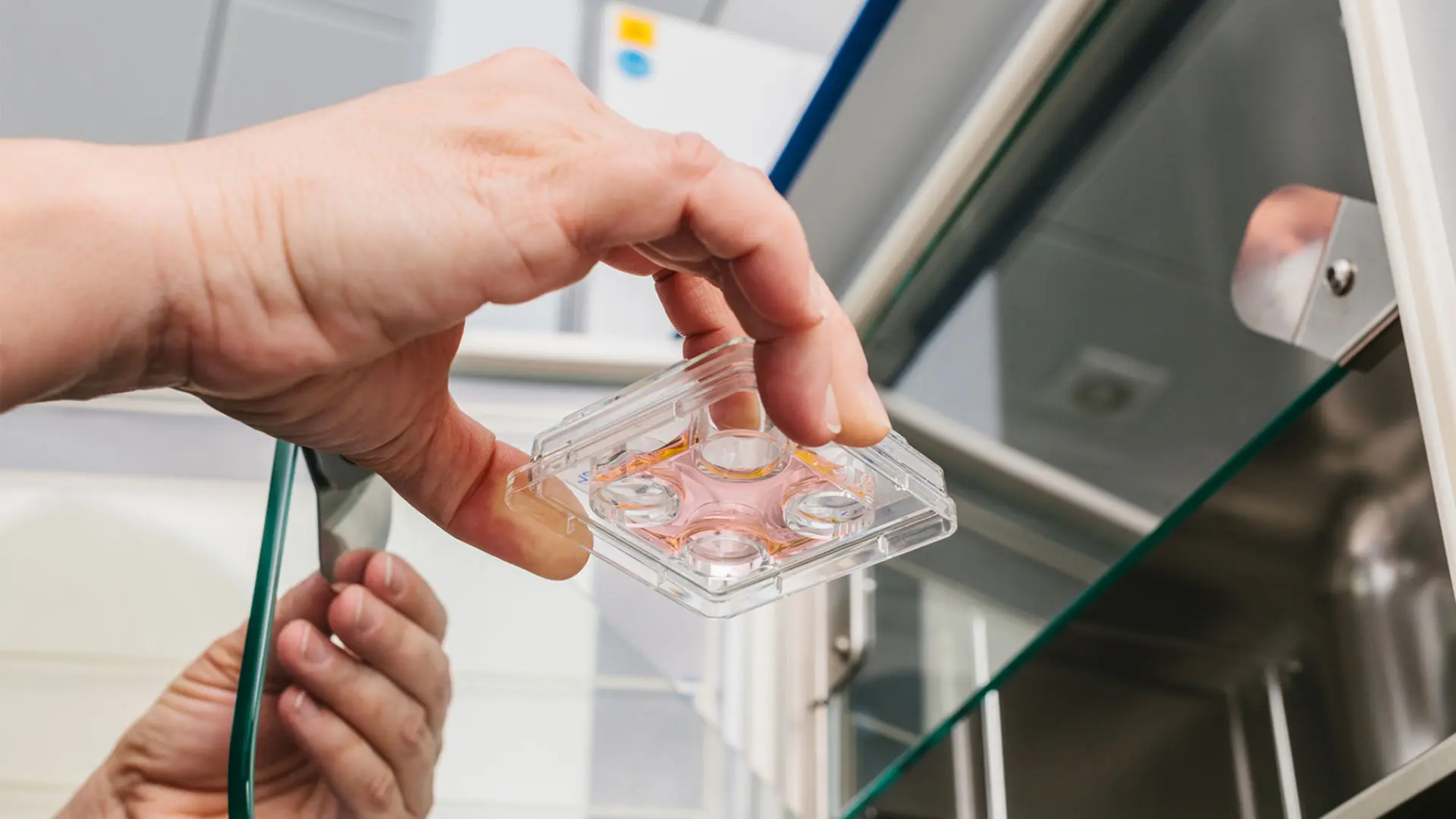 Preventing OHSS After Egg Retrieval: Tips for IVF Patients in Houston - Image