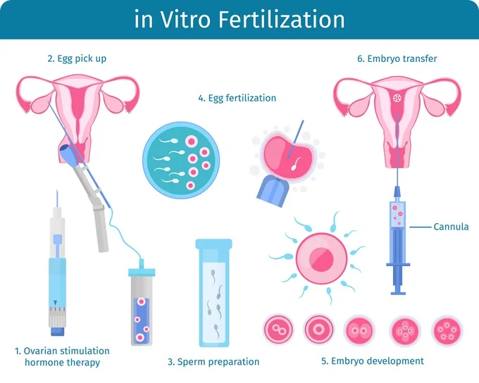 Inovi Fertility IVF Costs & Financing in Houston: Treatment Prices, Loans, and Payment Plans
